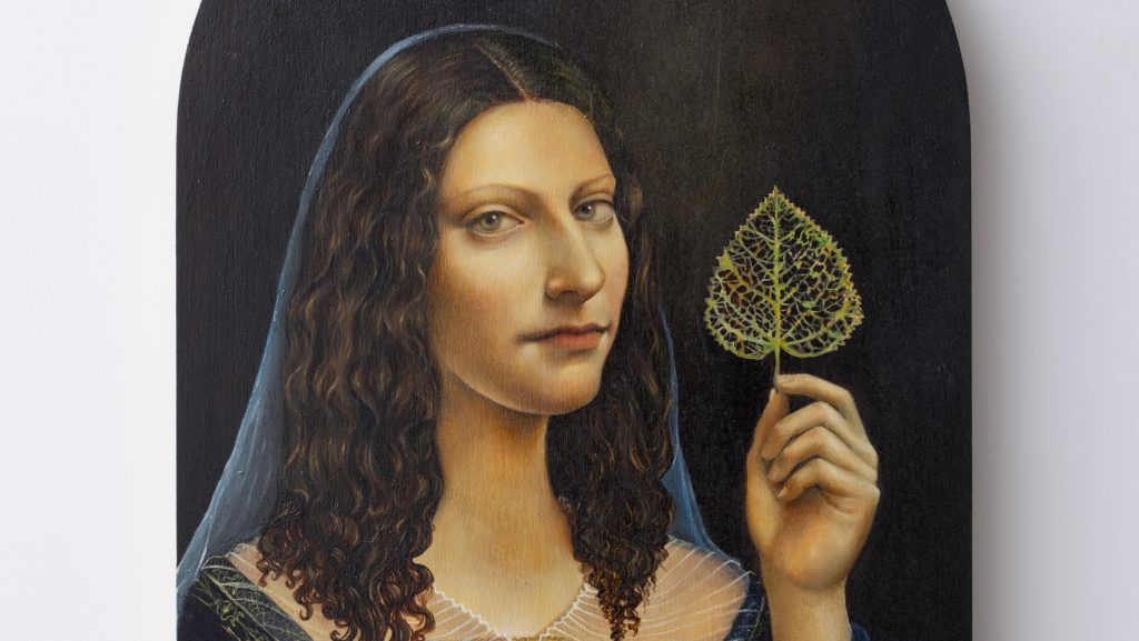 Elena Ceretti Stein: Sunburn